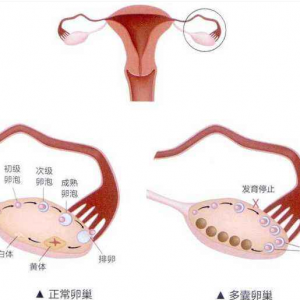“我只想生个女儿”：广州供卵代怀事件背后，是看不见的3大深渊